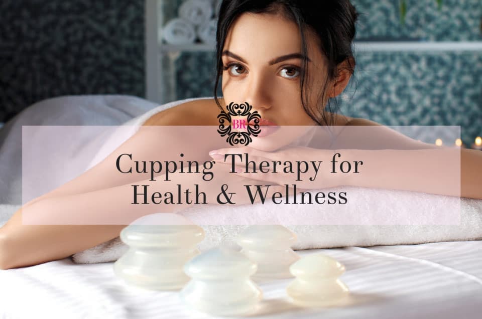 Cupping Therapy for Health and Wellness