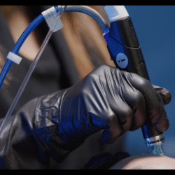 HydraFacial MD